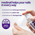 Nail Fungus Treatment Spray – Fast-Acting Formula for Healthy, Clear Nails